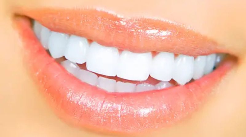 Secrets to a Hollywood Smile: Dental Care Tips That Work