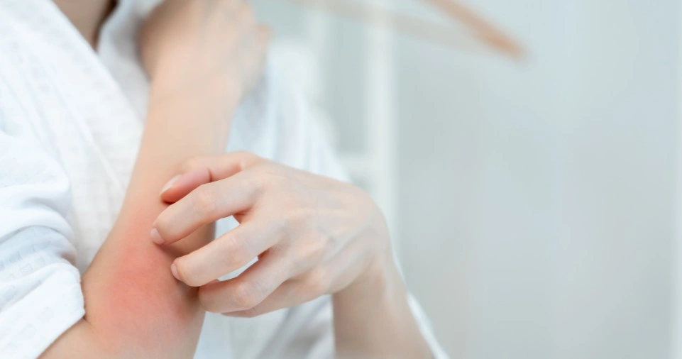 Ipswich Skin Screenings